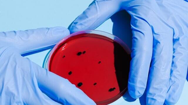 diagnostic-lab-sampling
