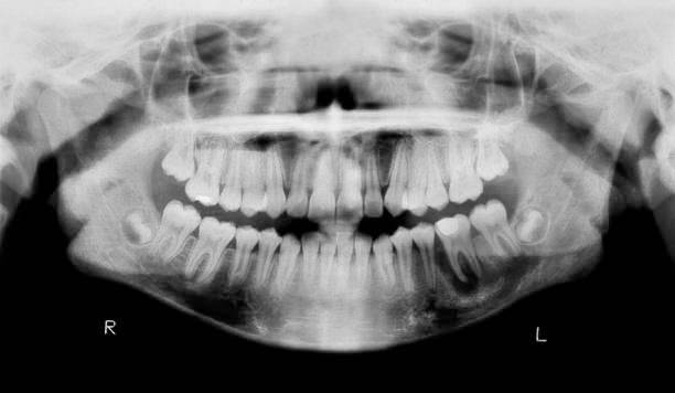 Toothache pain